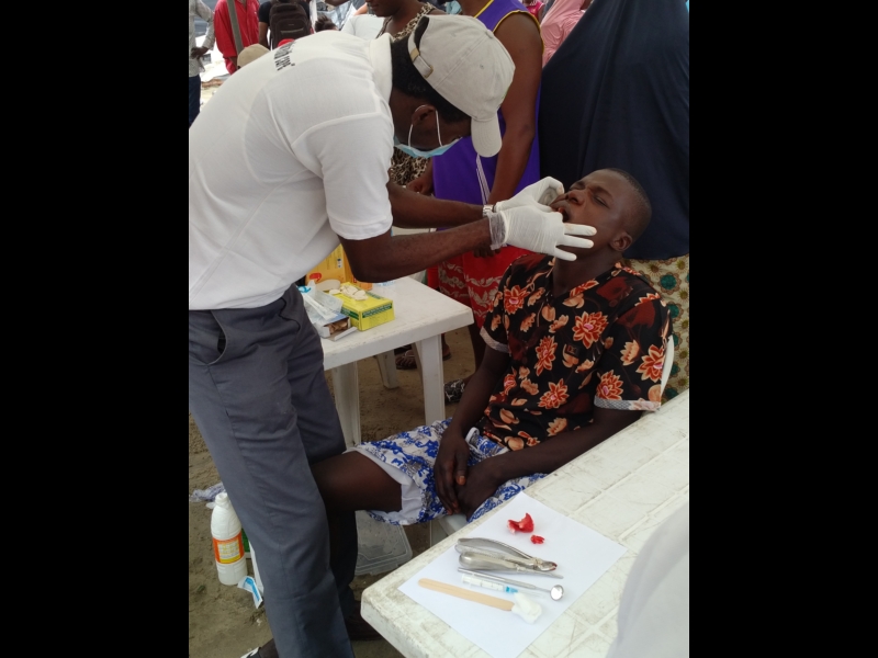 Dr Ebenezer Ajoloko (Dental surgeon) of Motus Health Initiative performing a dental extraction at the Aboki estate Lekki Free Medical outreach. — with Ajoloko Ebenezer Abiodun and Oyinlola Ebenezer.
